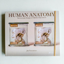 Human Anatomy: Stereoscopic Images Of Medical Specimens